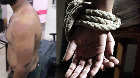 108 एम्बुलेंस के मैनेजर की जमकर पिटाई